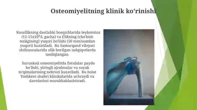 Osteomiyelit: ta'rifi va tasnifi 3