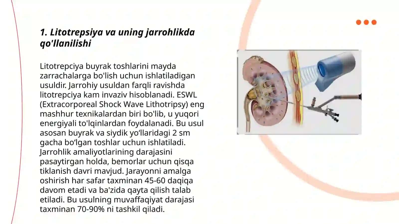 Litotrepsiya, laparoskopiyaning jarrohlikda qoʻllanilishi 3