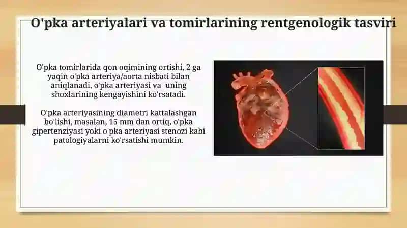 Yurak va Qon Tomirlarining Rentgen Anatomiyasi 3