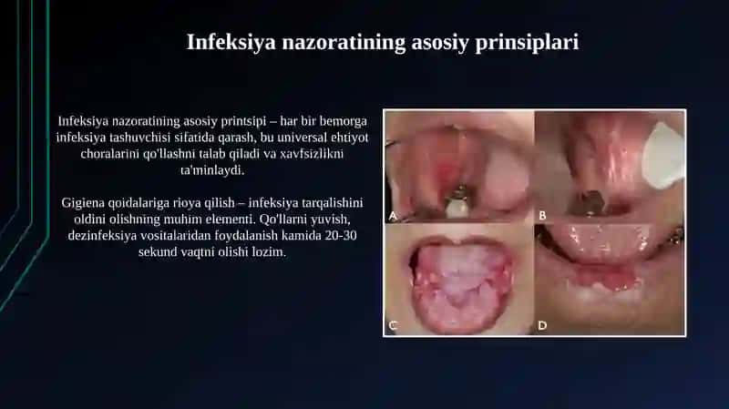 Stomatologik amaliyotda OIV infeksiyasi va virusli hepatitlarning oldini olish choralar 3
