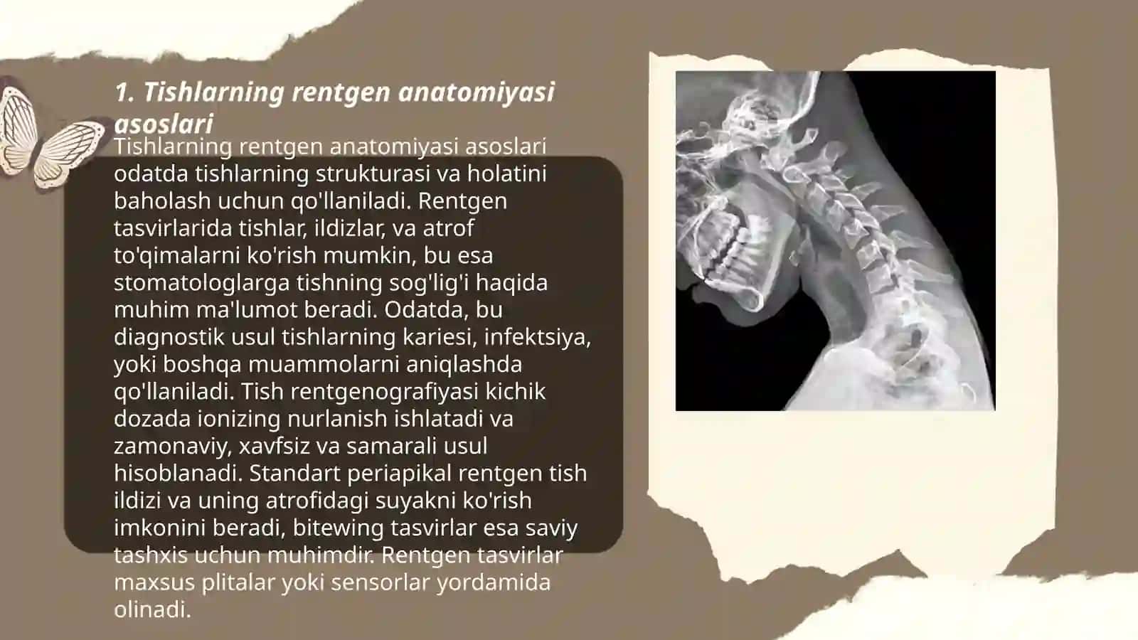 Tishlarning rentgen anatomiyasi 3
