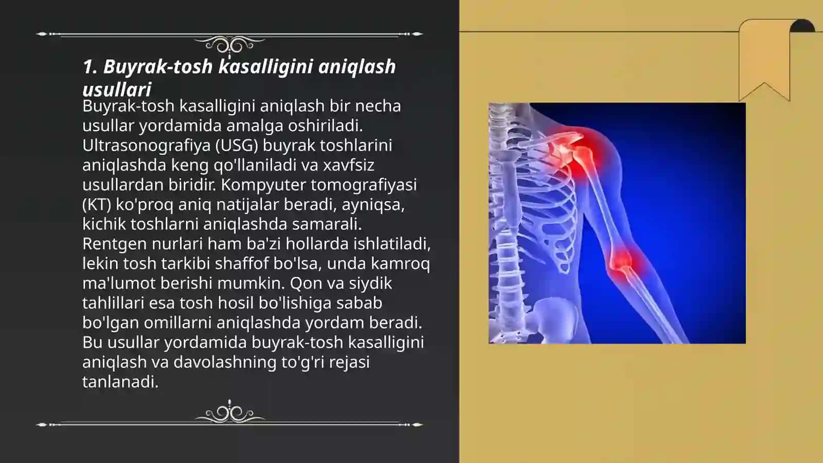 Buyrak-tosh kasalligi mohiyati 3