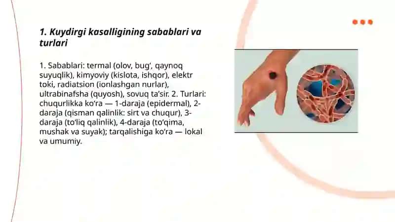 Kuydirgi kasalligi 3