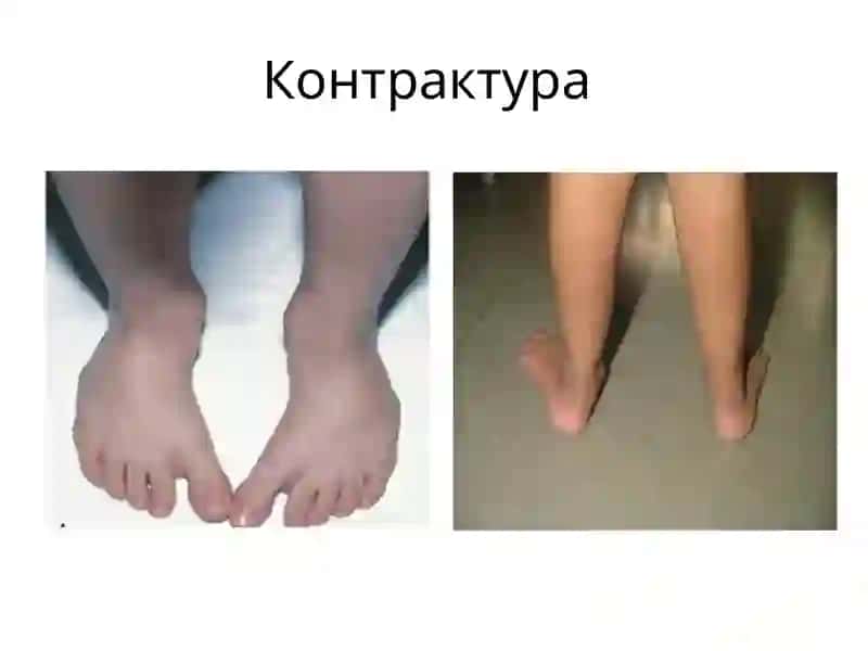 Травматология ва ортопедия, нейрохирургия кафедраси 3