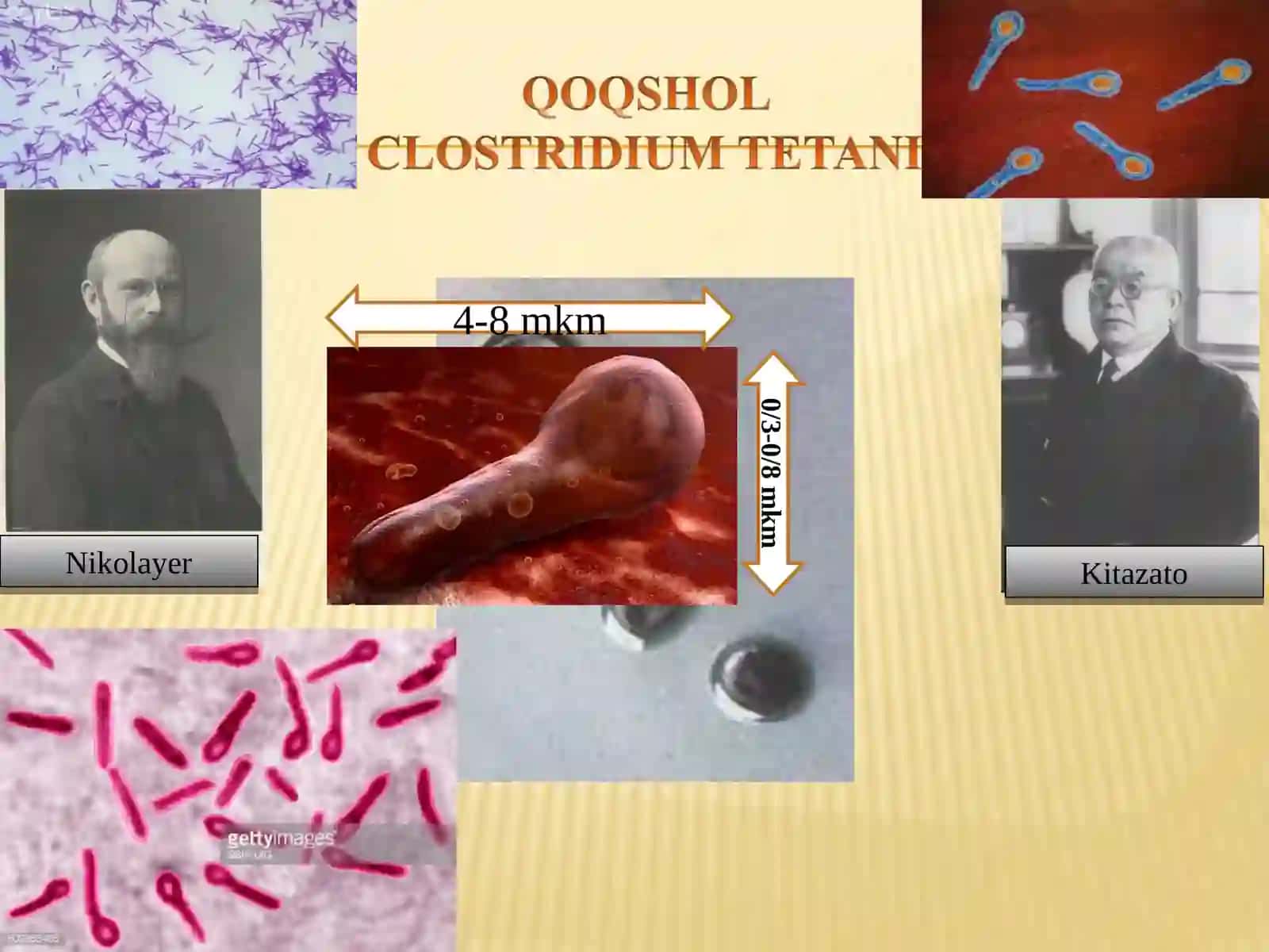 patogen anaeroblar. Qoqshol, gazli gangrena qoʻzgʻatuvchilar va ularning biologik xususiyatlari 3