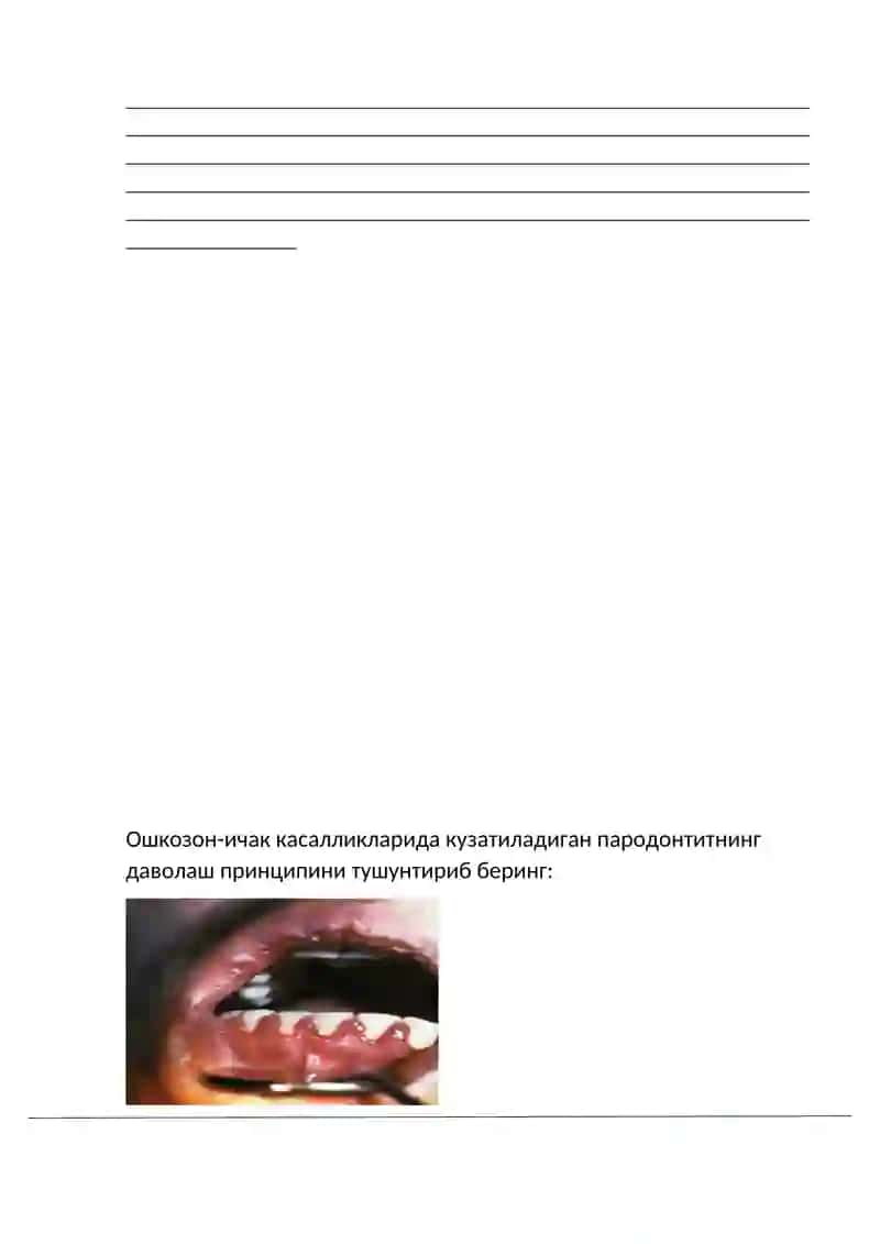 Bolalarda umumiy somatik kasalliklarda (endokrin sistema, YU.Q.T.S., asab sistemasi, hazm sistemasi) parodontdagi o‘zgarishlar 3