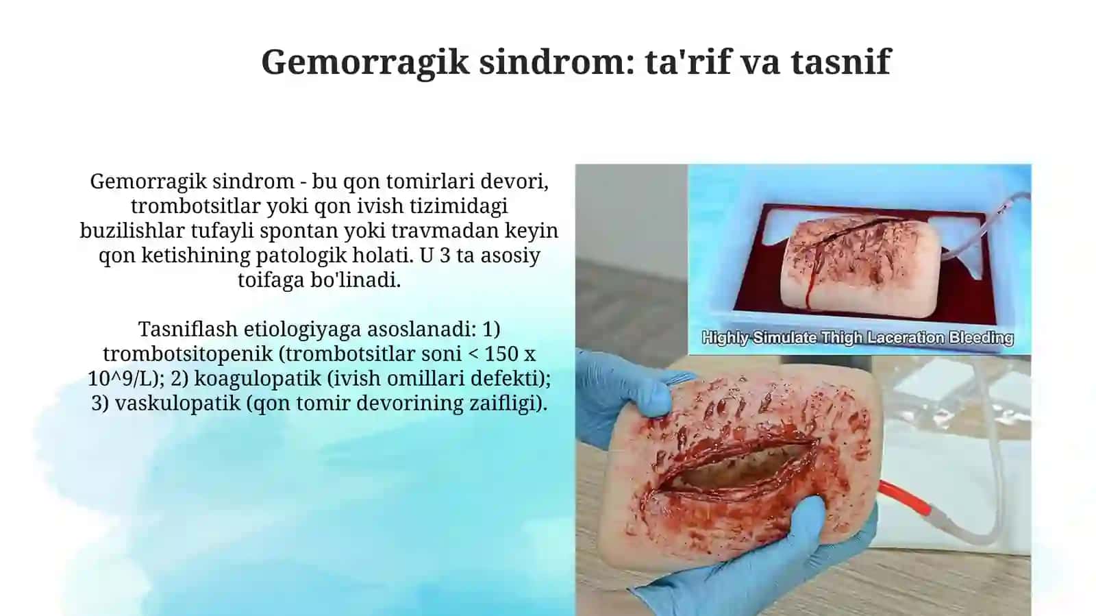 Gemorragik sindrom: ta'rif va tasnif 3