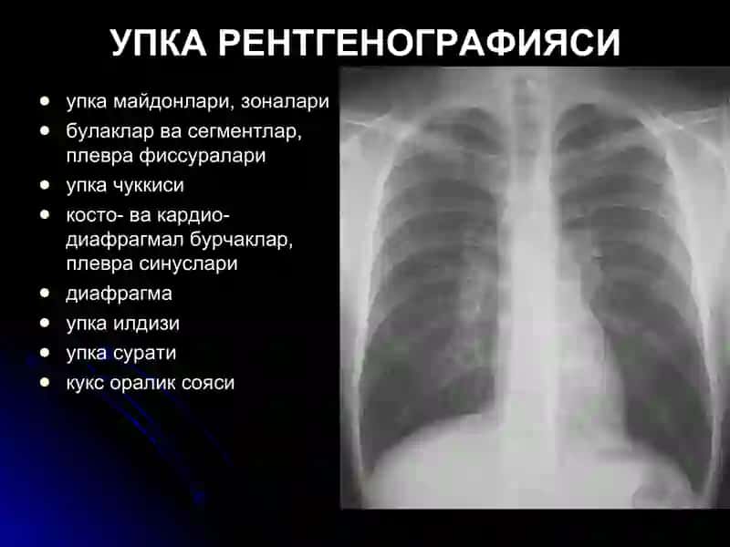 УПКА КАСАЛЛИКЛАРИНИНГ НУР ТАШХИСИ 3