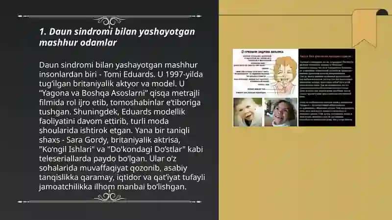 Daun va Autizm kassaligi bor mashxurlar 3