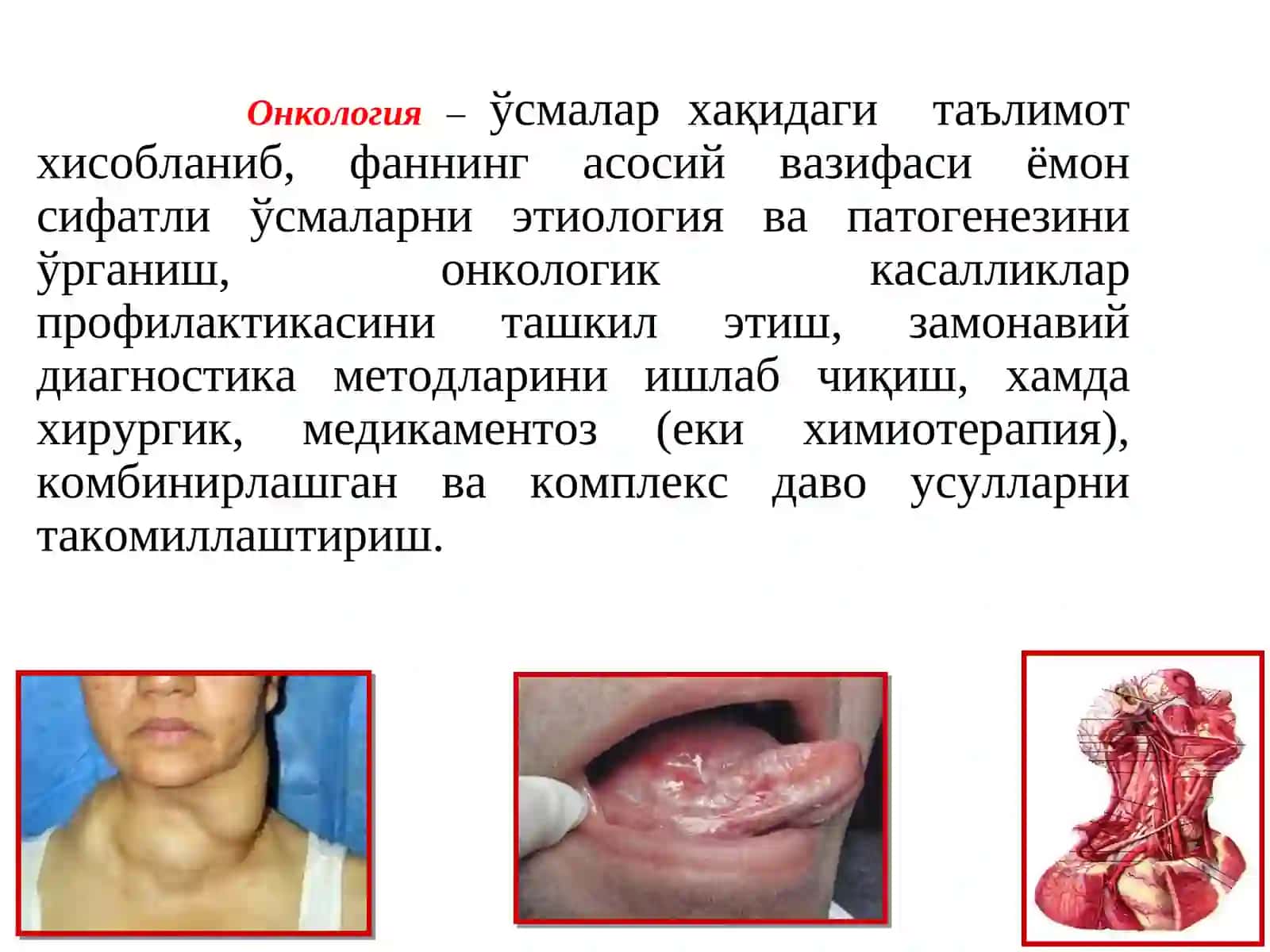 Злокачественные эпителиальные опухоли челюстей 3