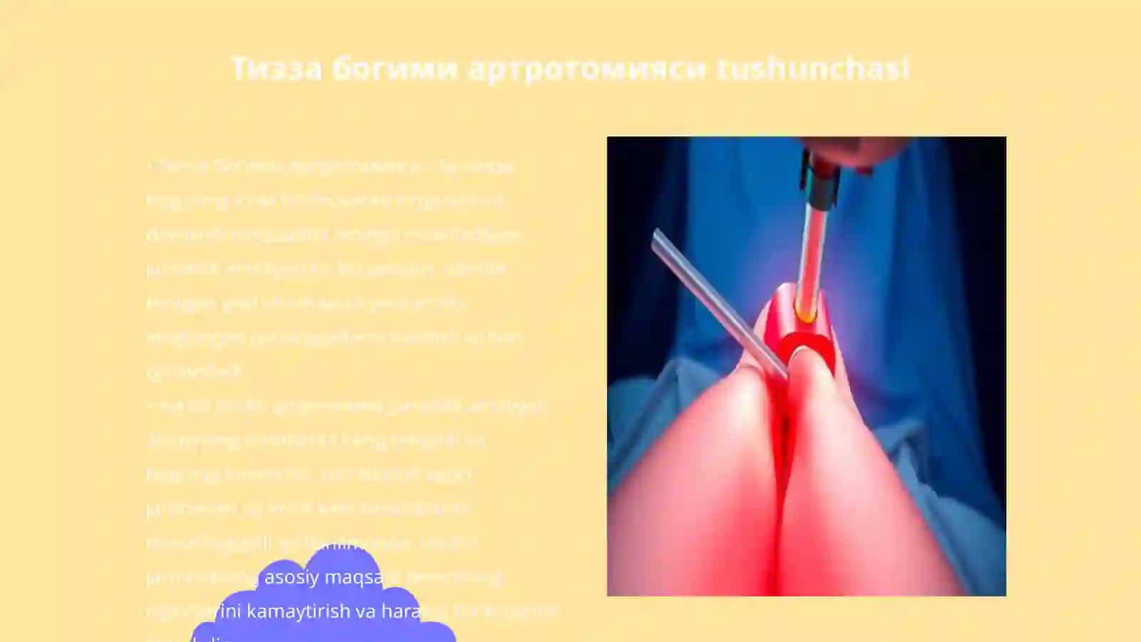 Тизза богими артротомияси 3