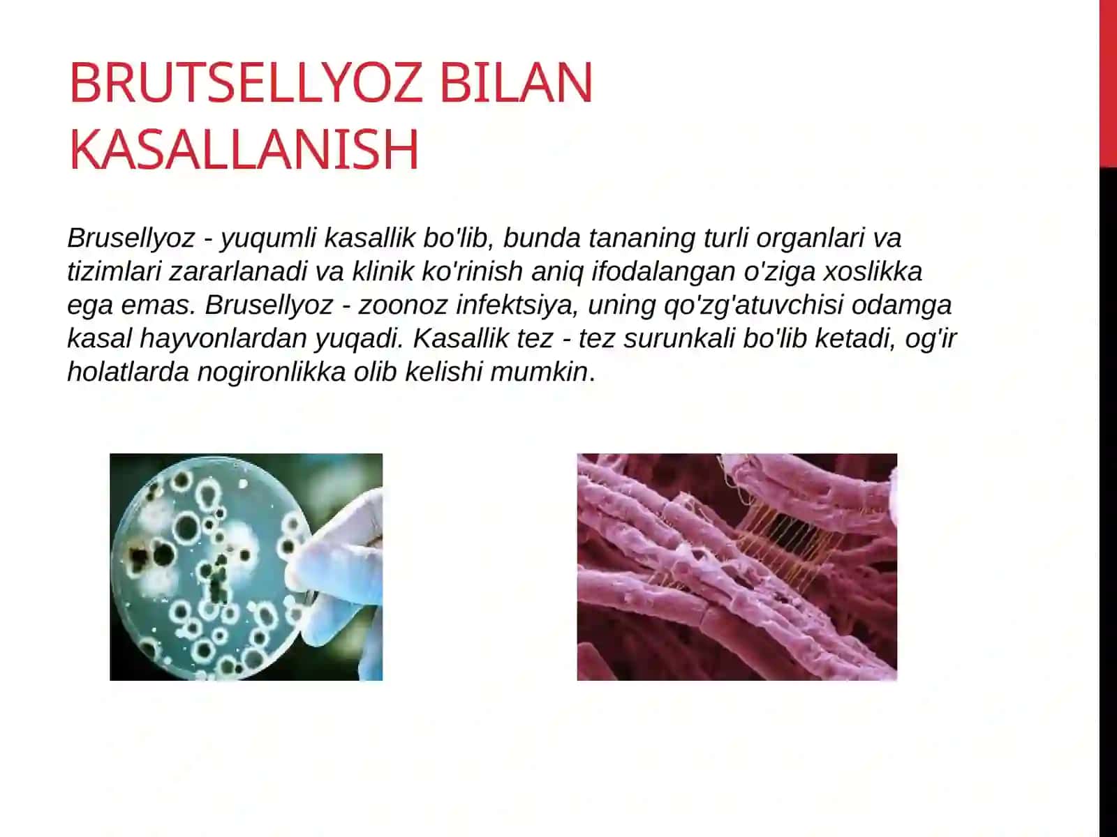 Brutsellyoz 3