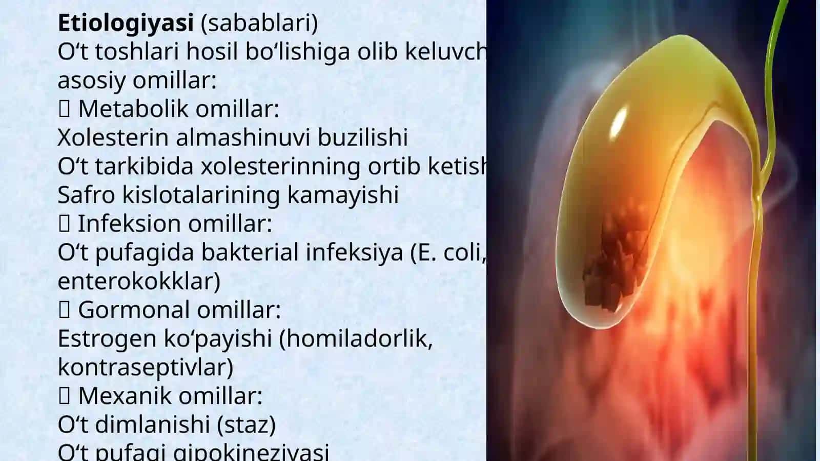 Oʻt tosh kasalligi etiologiyasi patogenezi klinikasi asoratlari davolash usullari 3