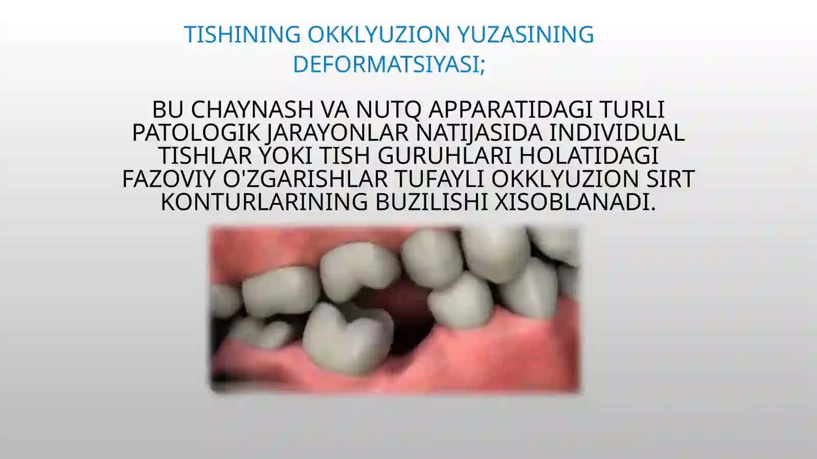 Tish qatori deformatsiyalarida okklyuziyani shakillantirishning gnatalogik asoslari 3
