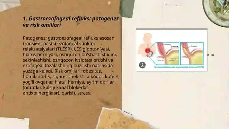Gastroezofagal reflyuks.Gijja invaziyasi Mavlonova Ruxshona 3