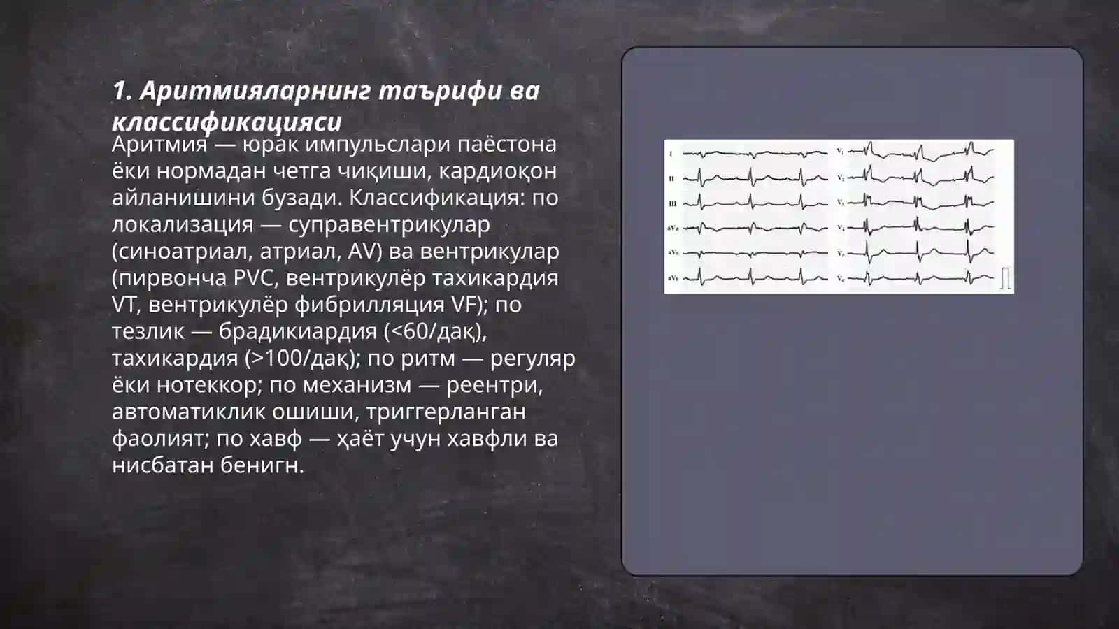 Аритмиялар 3