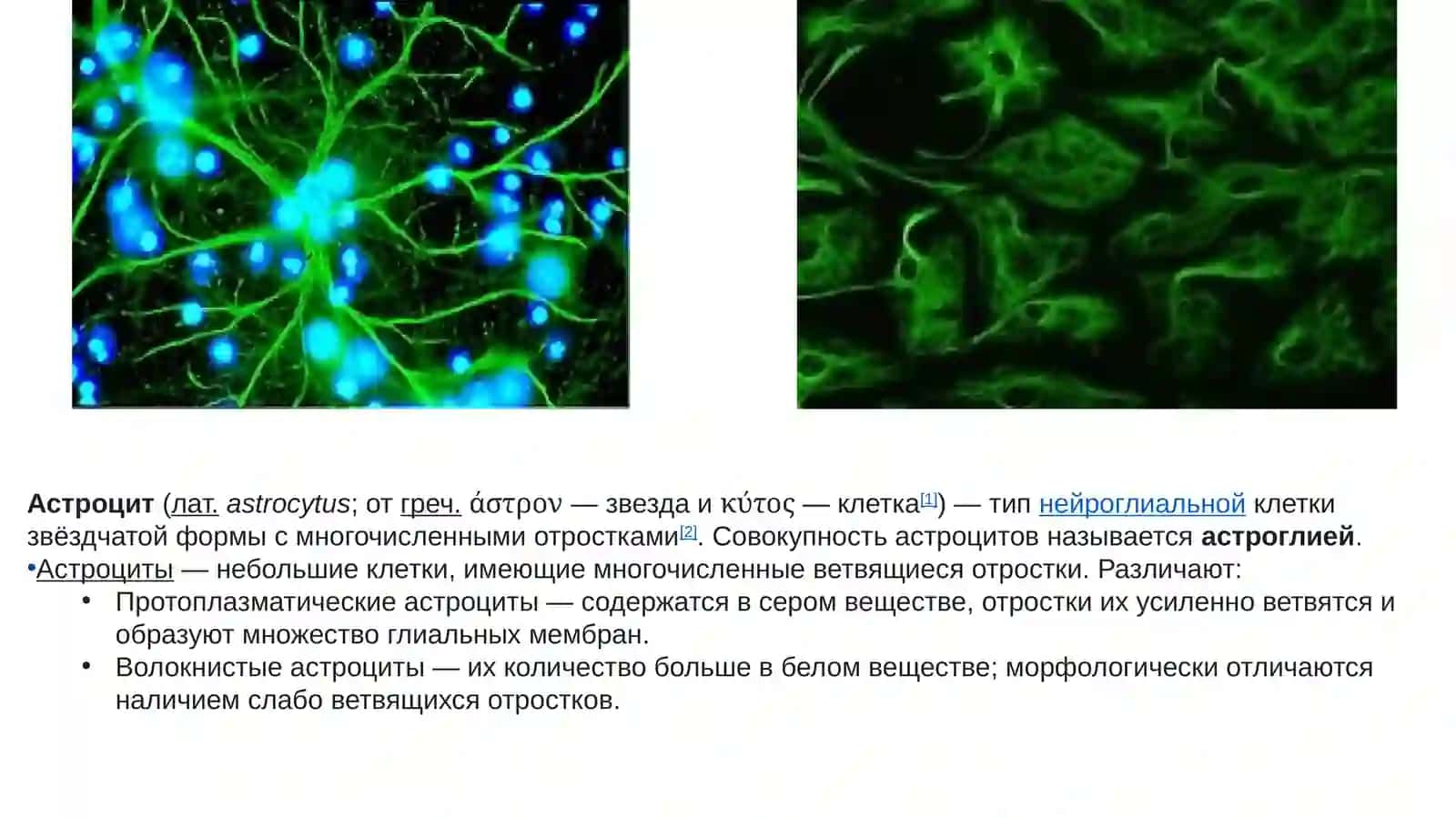 Иллюстрация четырёх типов глиальных клеток, находящихся в ЦНС 3