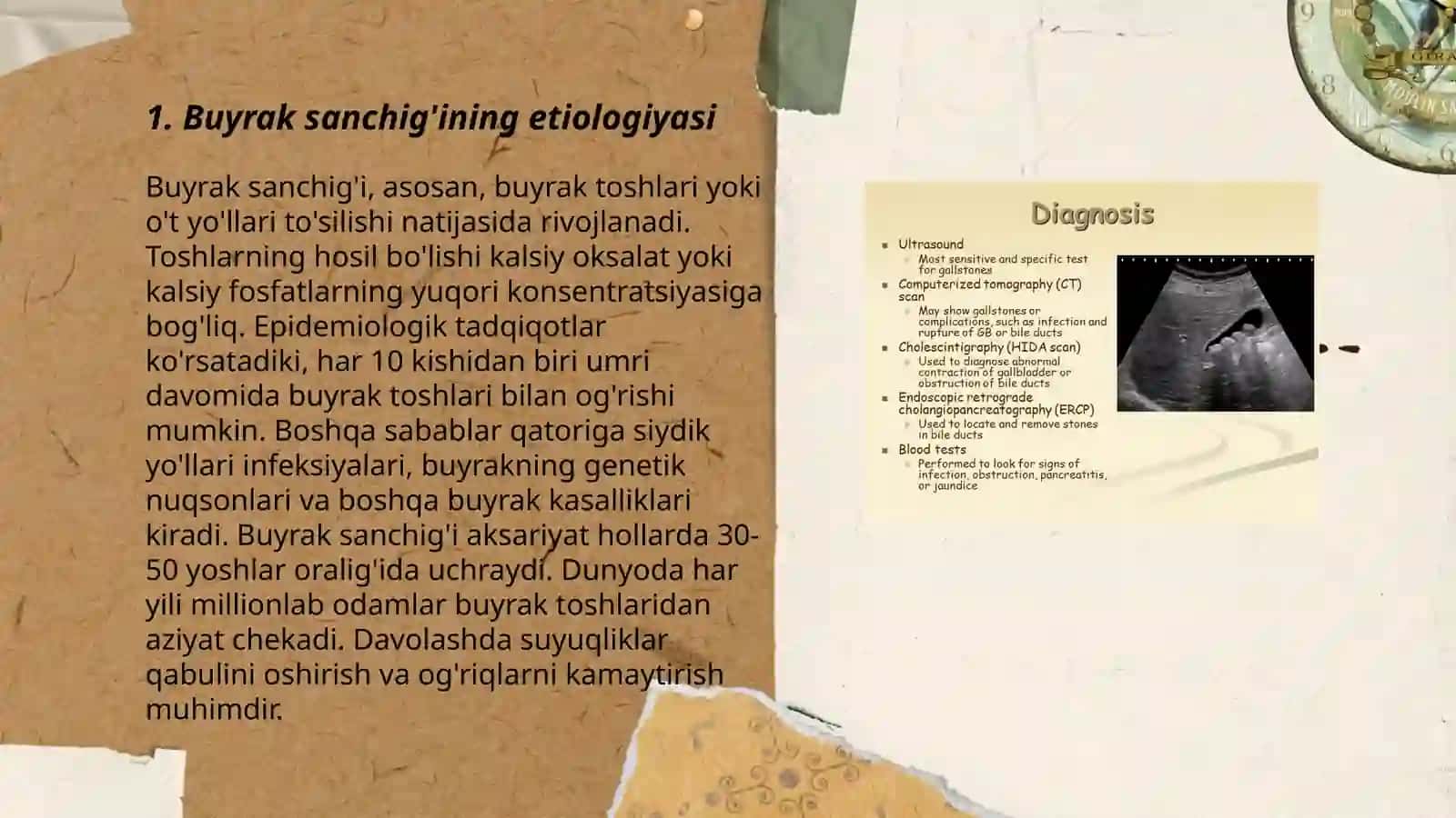 Buyrak sanchig'i.Klinikasi diagnostikasi va UASh taktikasi 3