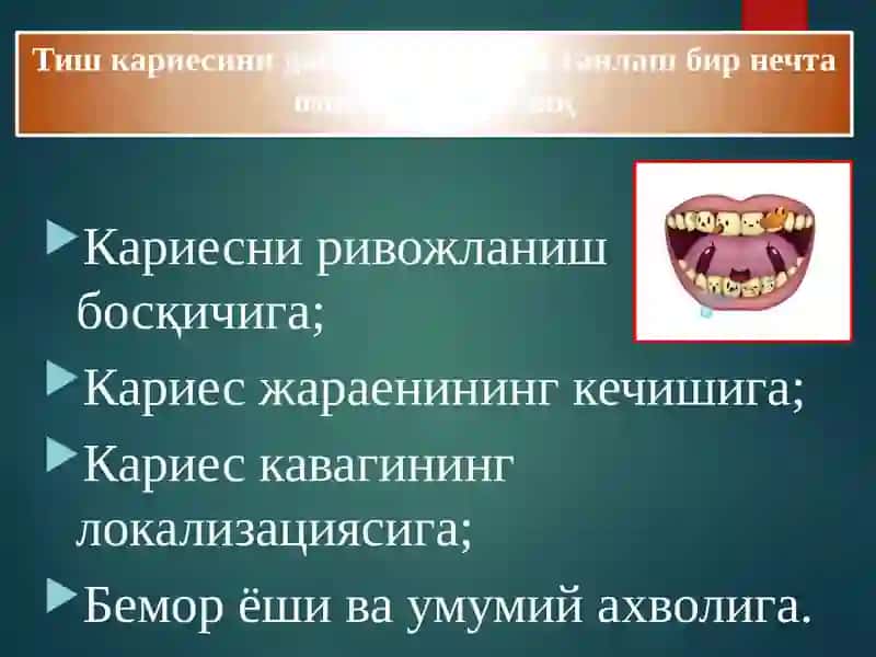 Кариеснинг клиник таснифи 3