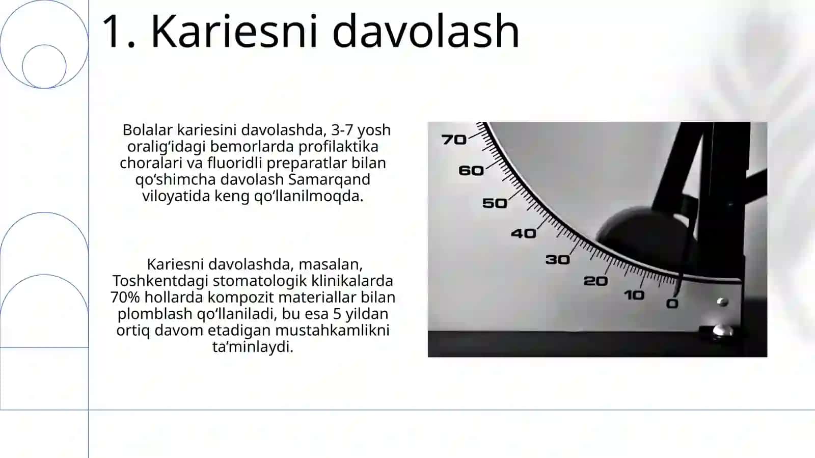 Karies haqida tushuncha. Karies kovaklarining tasnifi 3