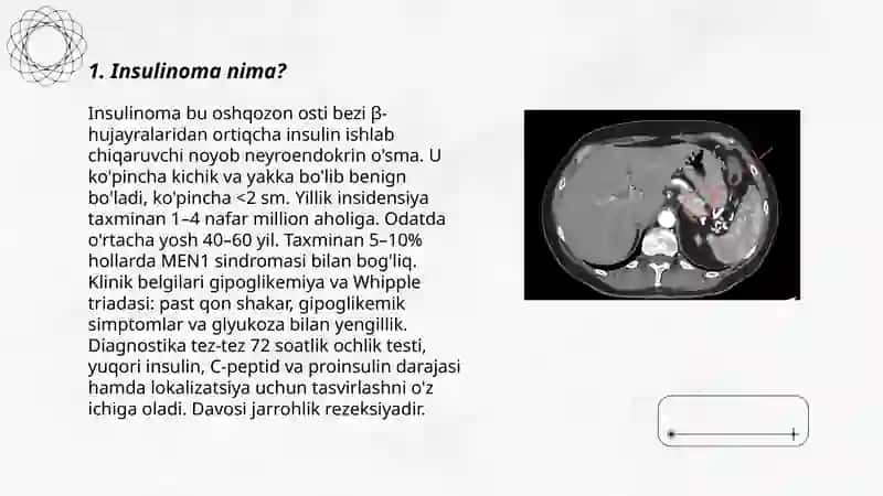 Insulinoma 3