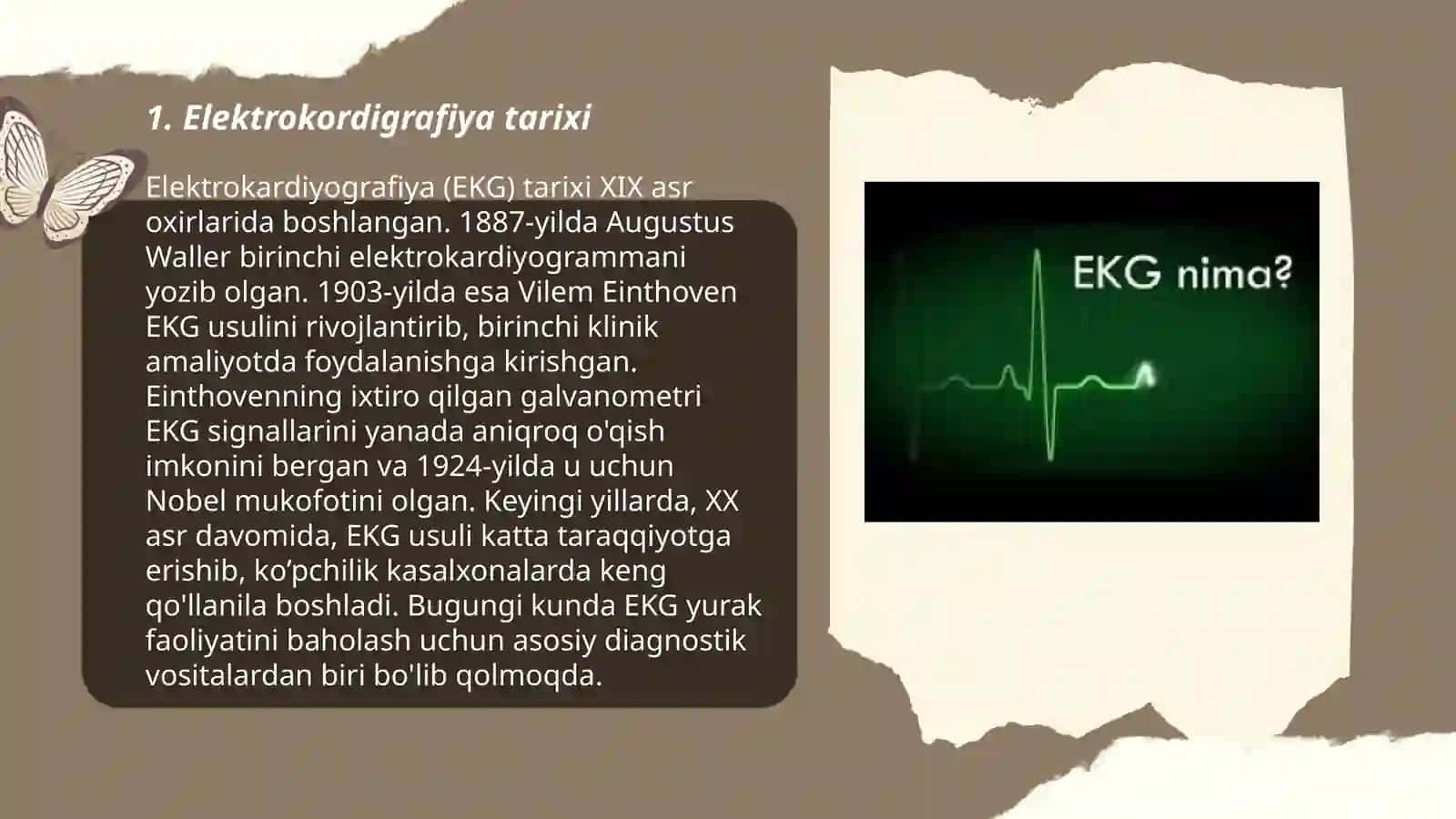 Elektrokordigrafiya 3