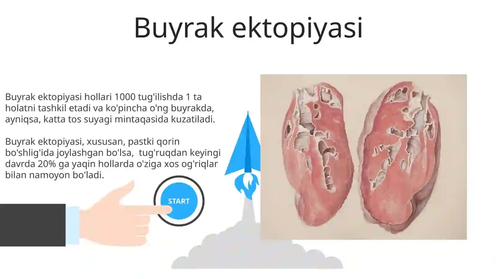 Buyrak anomaliyalari 3