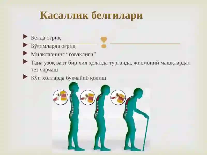 Остеопороз 3