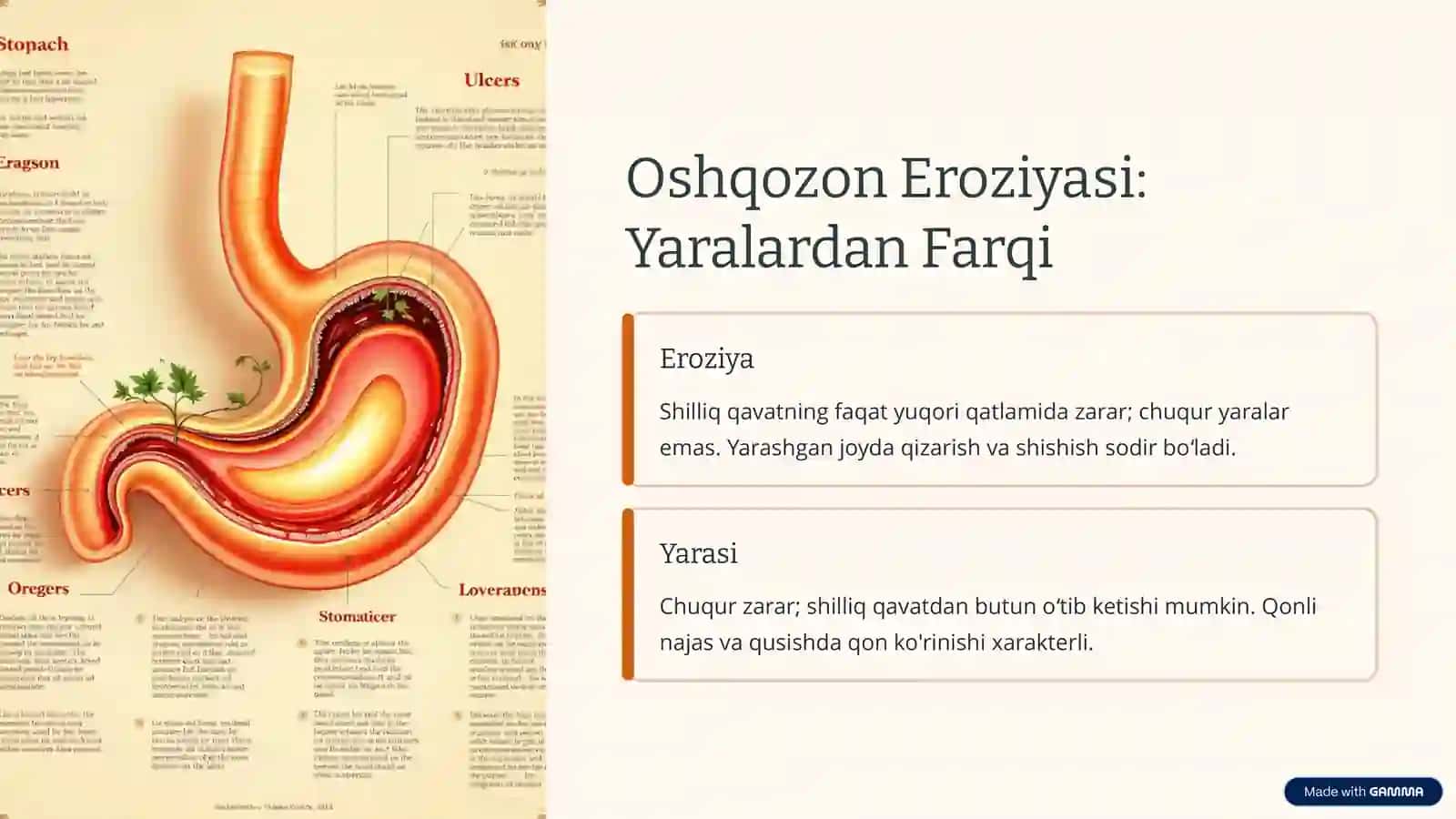 Otkir oshqozon yaralari 3