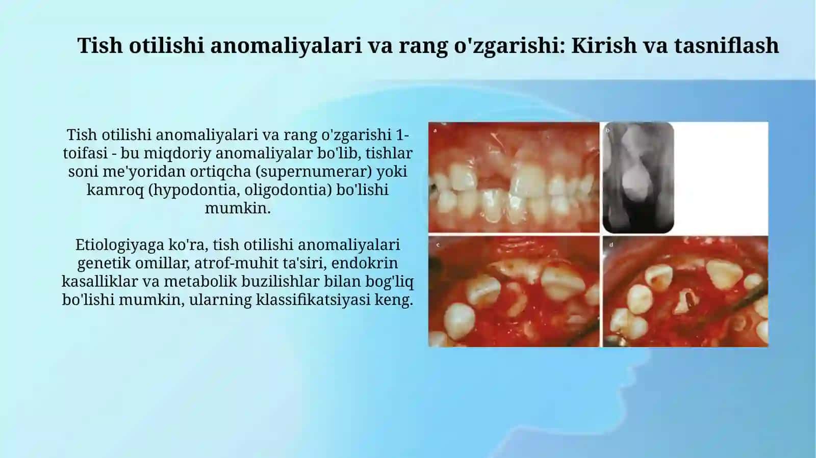 Tish chiqish anomaliyalari va rang o’zgarishi 3