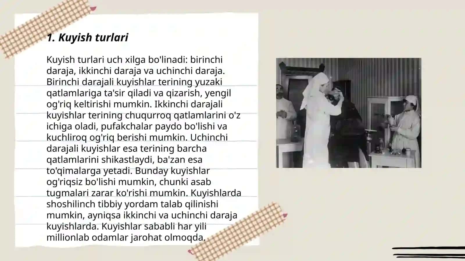 Kuyish.Kuyishning klassifikatsiyasi.Kuyishda yordam ko'rsatish 3