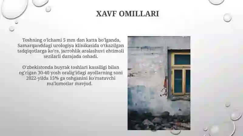 Oʻt tosh kasalliklari 3