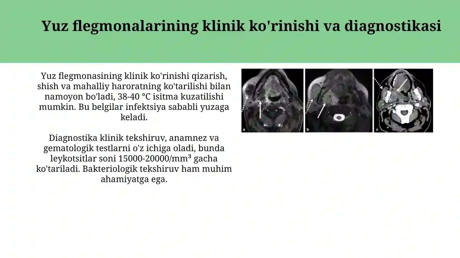 Yuzning yuza flegmonalarining ochish hamda drenejlashning klinikanatomikasoslari 3