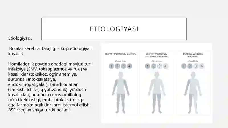 Bolalar serebral paralichi 3