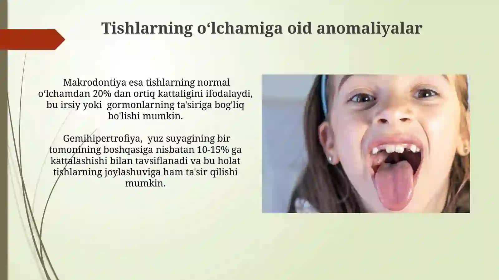 Tishlarning oʻlchamiga oid anomaliyalar 3