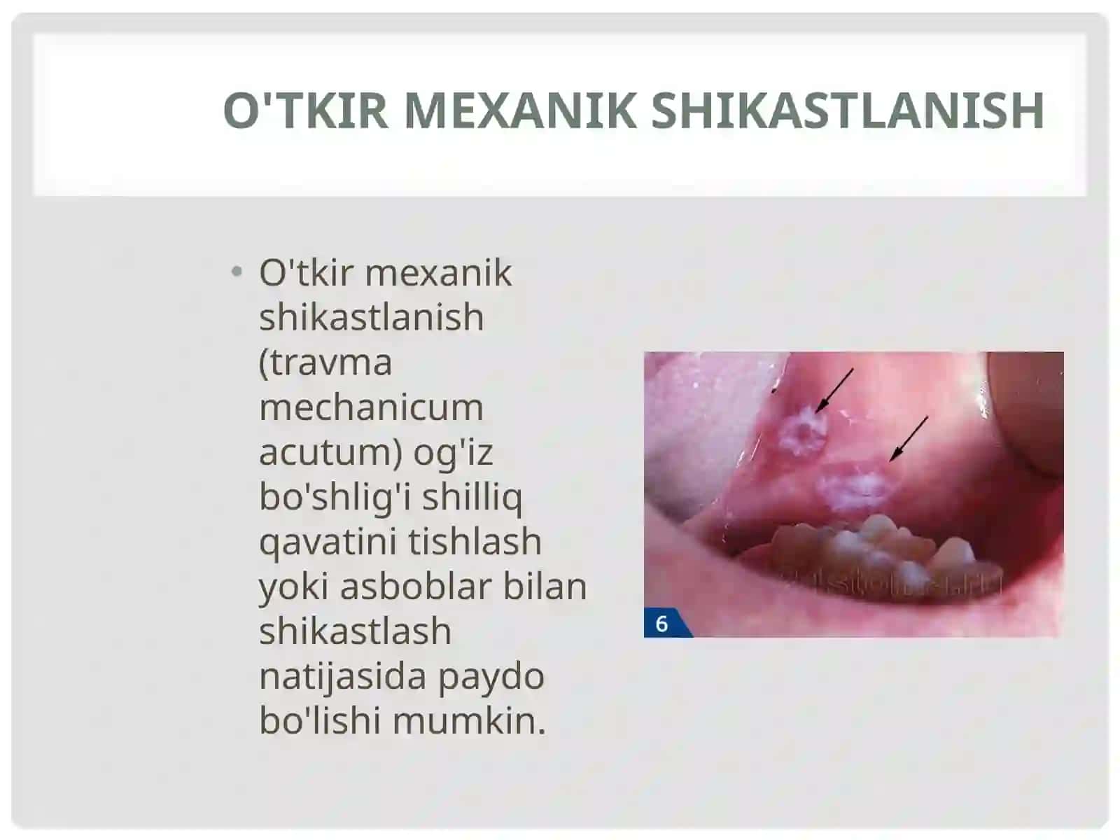 Og‘iz bo‘shlig‘i mexanik shikastlanishlari va ularning oldini olish choralari. 3