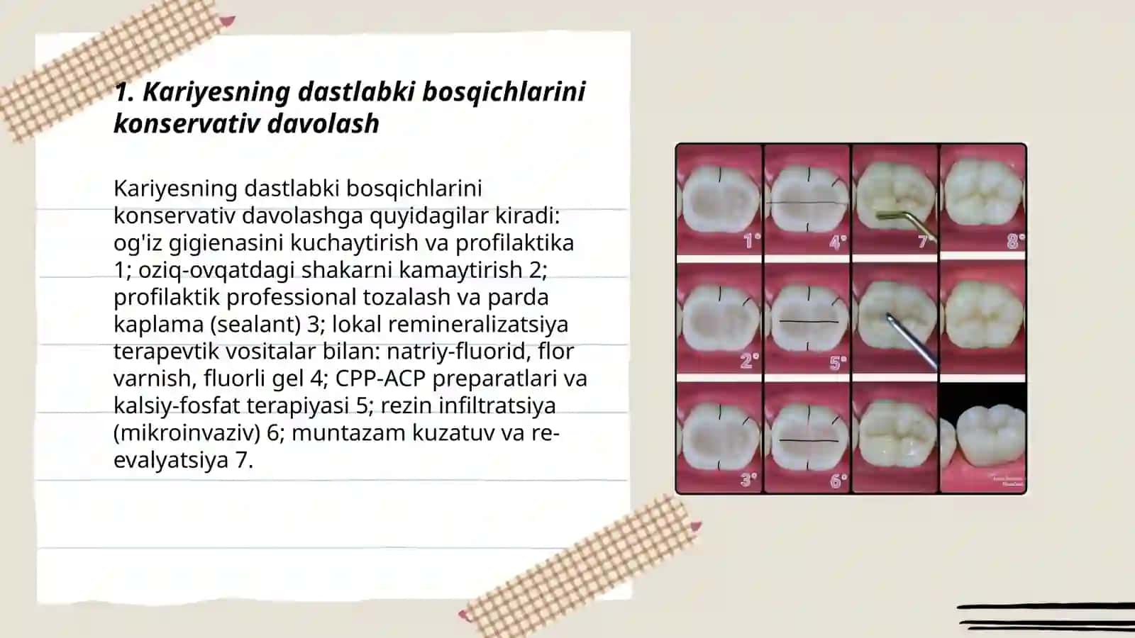 Kariyes kasalligining umumiy davolash 3