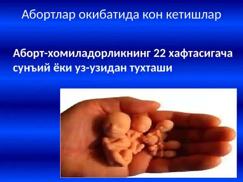 Абортлар окибатидаги конкетишлар 3