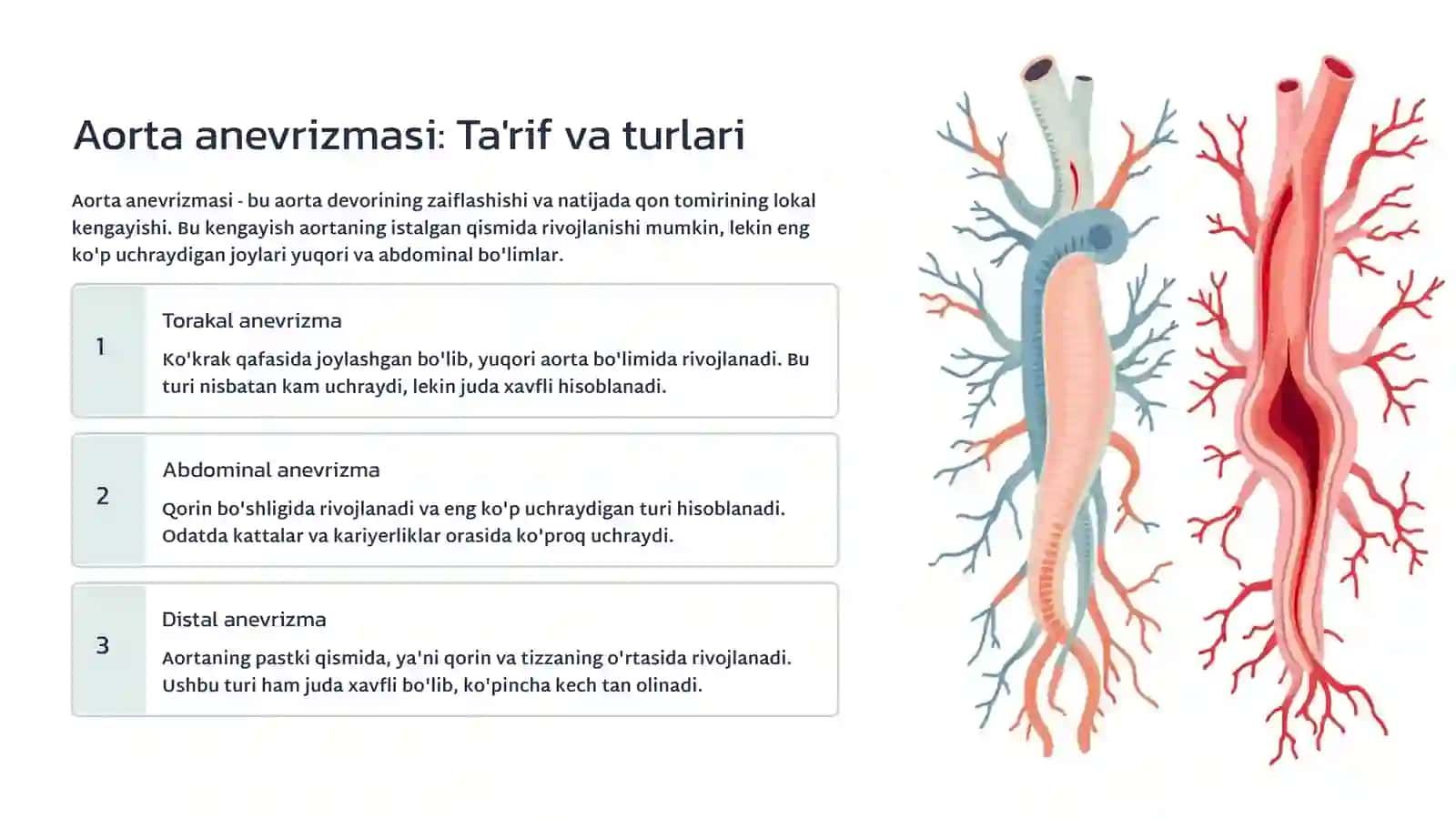 Aorta anevrizmasi: Tushuncha, xavf omillari va davolash 3