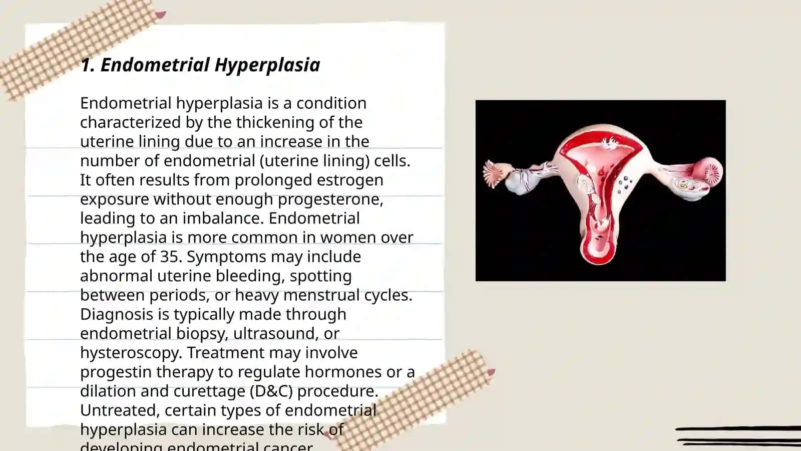 Inflammatory diseases of the uterus. Surgical practice 3