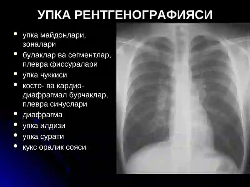 Ўпка касалликлари нур ташхиси 3
