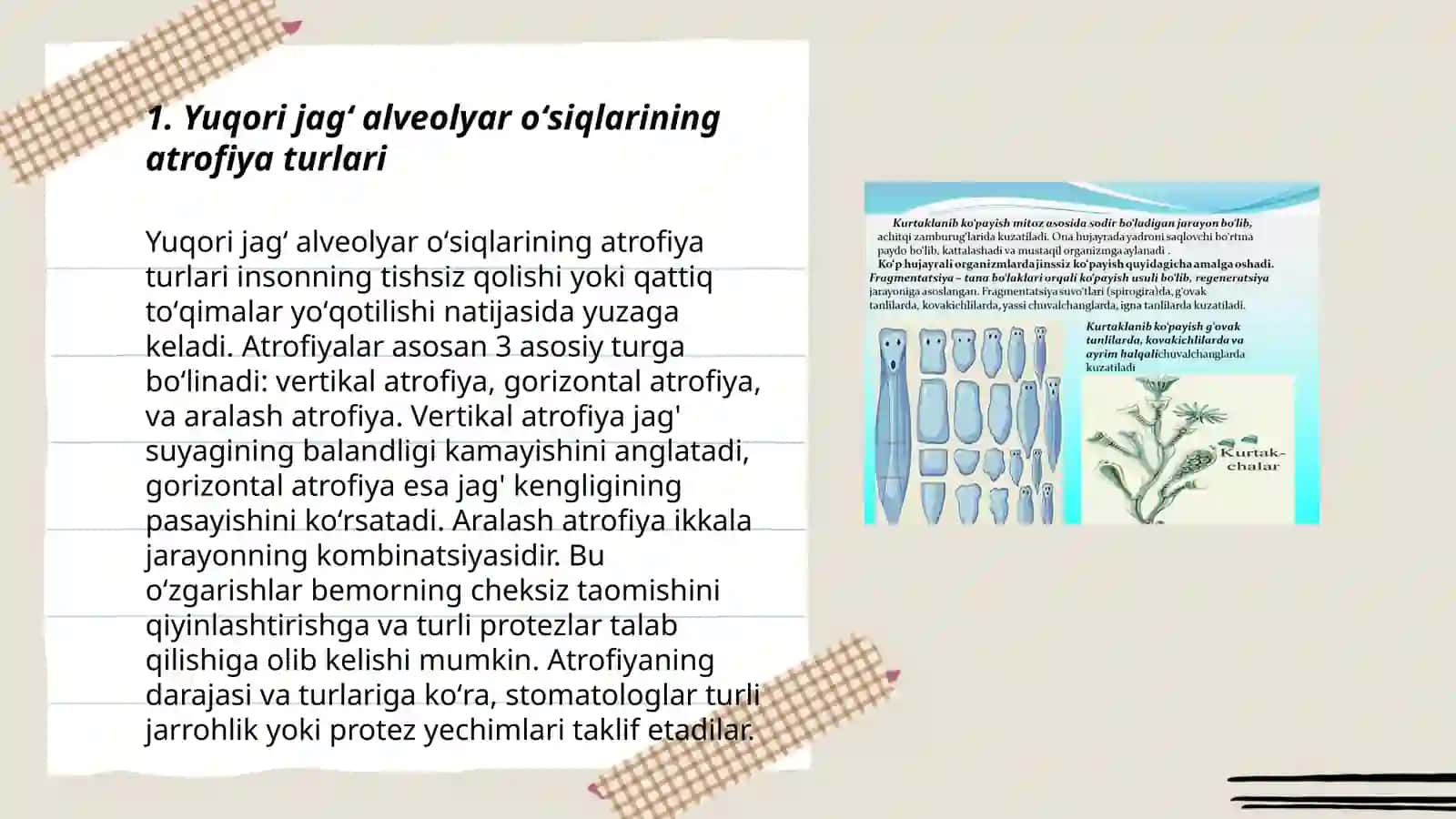 Yuqori va pastki jag' alveolyar o'siqlari atrofiyasining klassifikatsiyasi va atrofiyani bartaraf etish usullari 3
