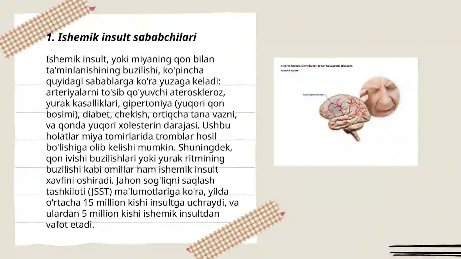 Ishemik insult 3