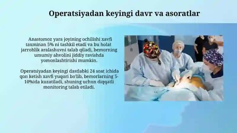 Megakolon va grishprung kasallikdagi operatsiyalar 3