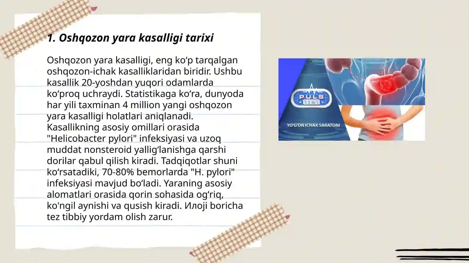 Oshqozon yara kasalligi etiopatogenezi 3