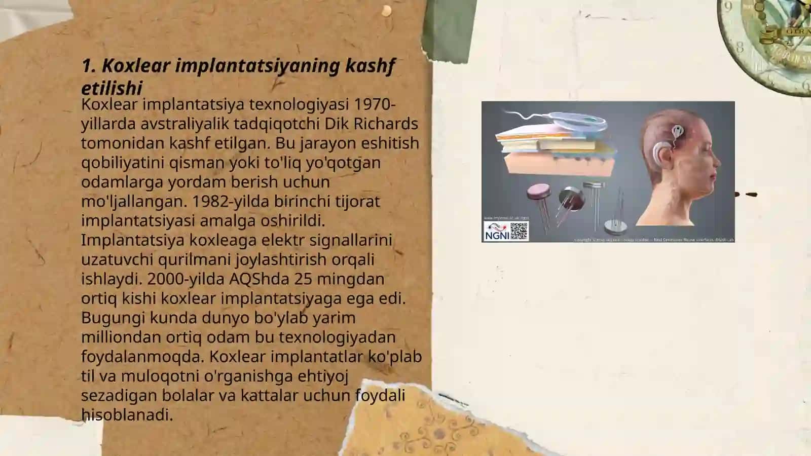 Koxlear implantantning yaratilish tarixi 3