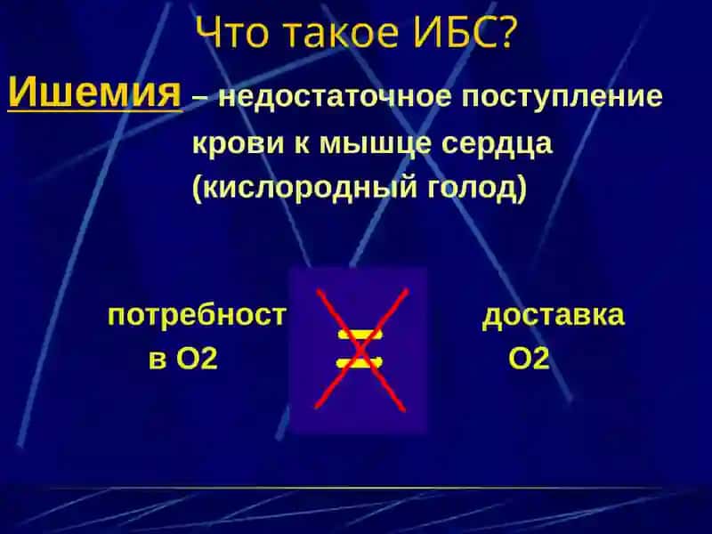 Ишемическая болезнь сердца 3