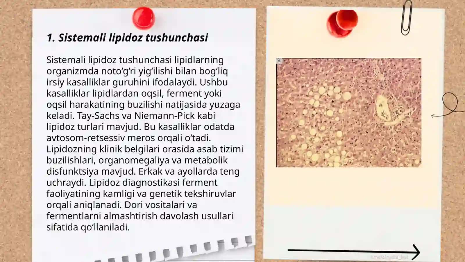 Sistemali lipidoz Goshe, Tey-Saks, Nimman-Pik kasalliklarining patalogik anatomiyadagi roli 3