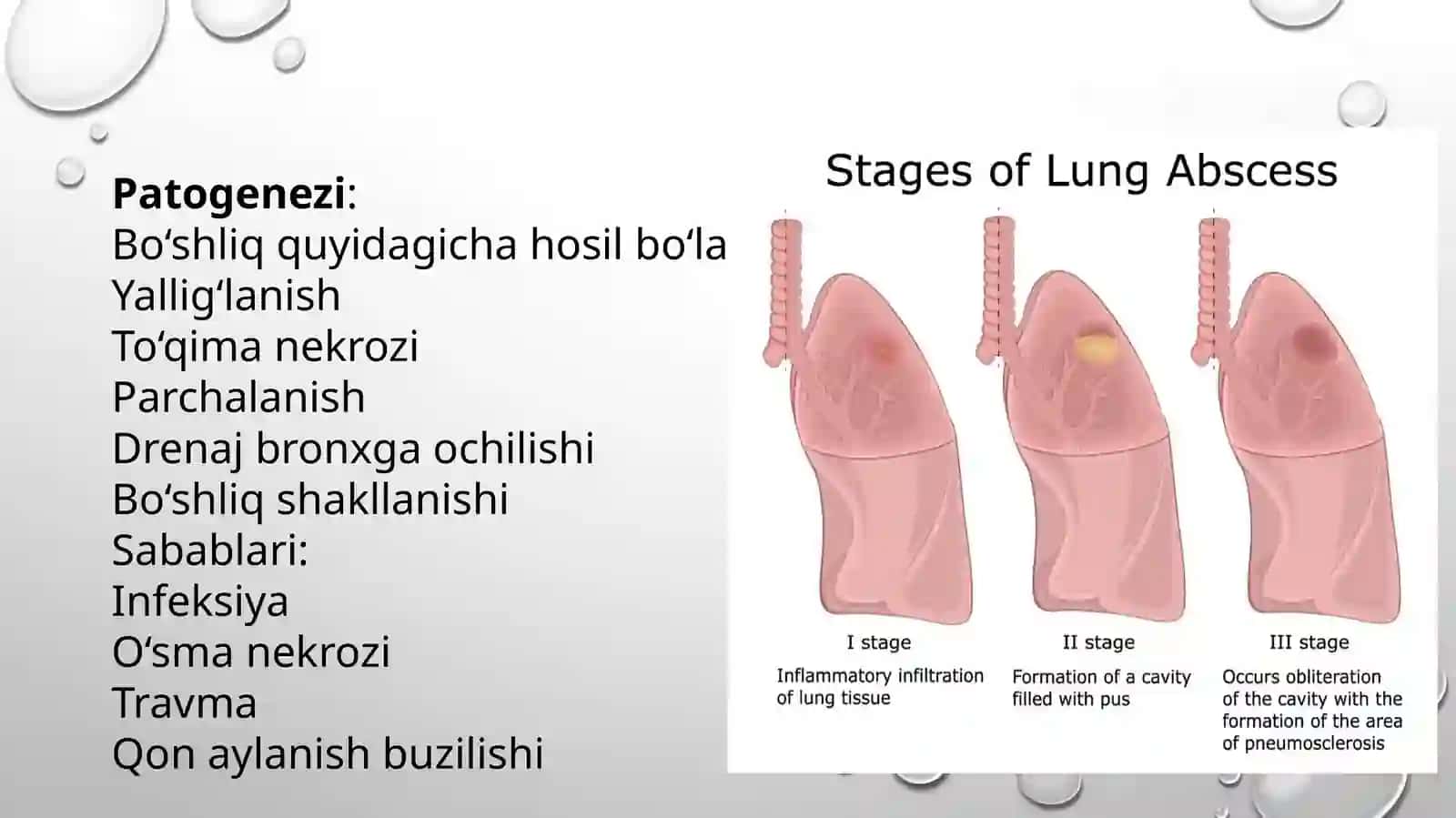Oʻpka ichidagi boʻshliqlarni qiyosiy tashxislash 3