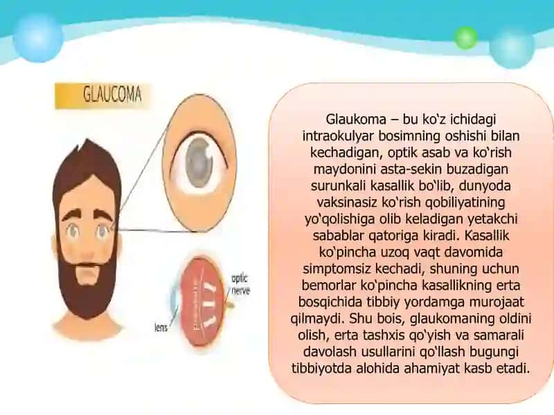 Glaukoma. Profilaktika, diagnostika va davolash. 3